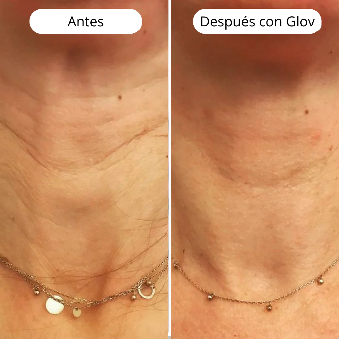 GLOV Microinfusión Antienvejecimiento